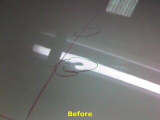 Dent 4