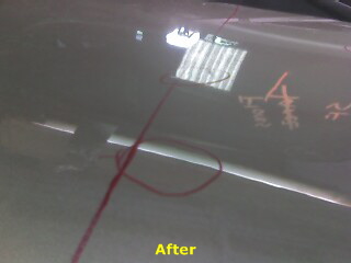 Dent 5